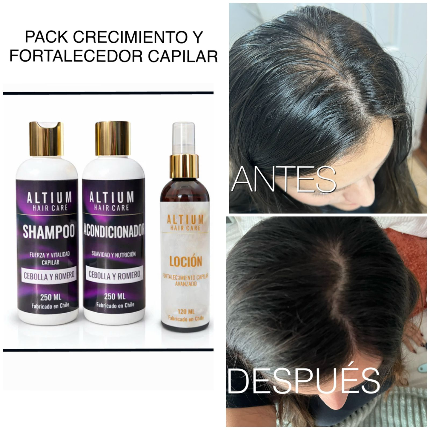SPRAY TRATAMIENTO CAPILAR AVANZADO  FORTALECEDOR CUERO CABELLUDO
